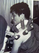 Traditional bamboo cupping treatment