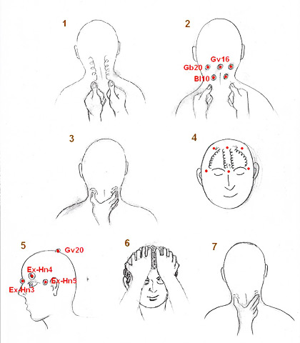 Acupressure protocol for headaches (I)