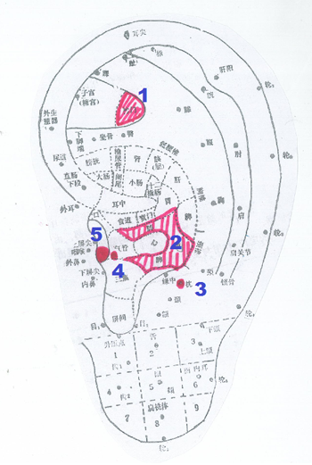 Auricular stimulating points for skin itching