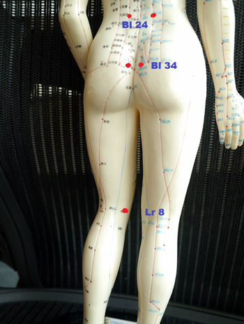 Common acupuncture points for itchy vulva