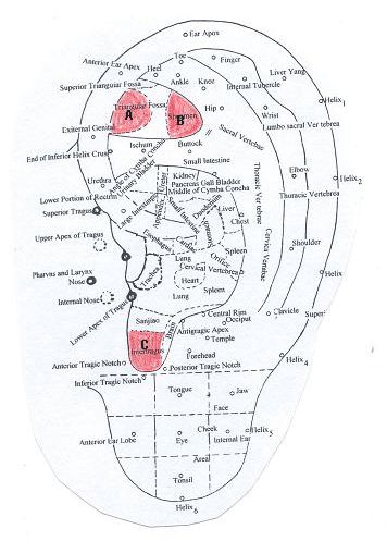 Auricular Acupuncture Chart