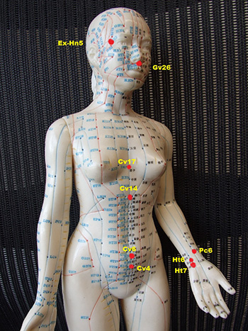 2. Commonly Used acupoints for hypertension