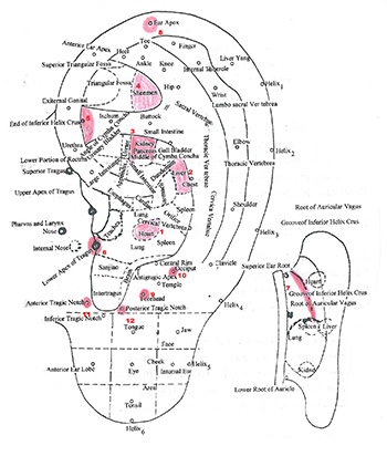 Commonly used ear points for hypertension 