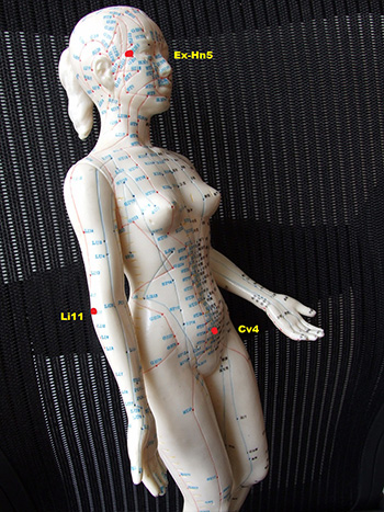 2. Cupping locations for hypertension