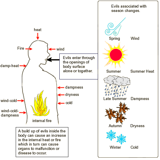 Tcm Headache Chart